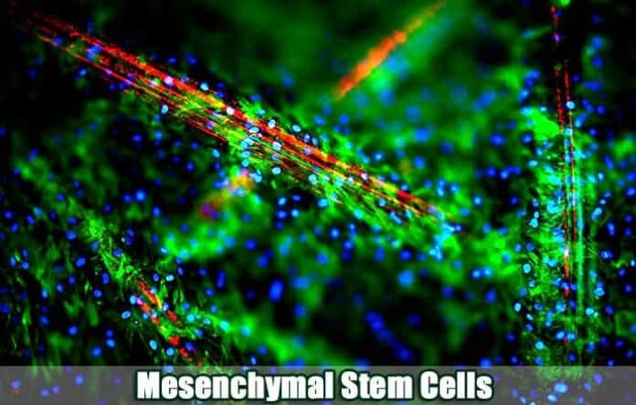 Mesenchymal Stem Cells Mesenchymal Stem Cells