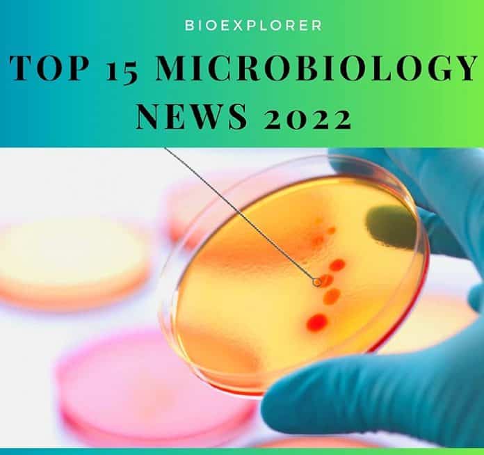 microbiology research topics 2022