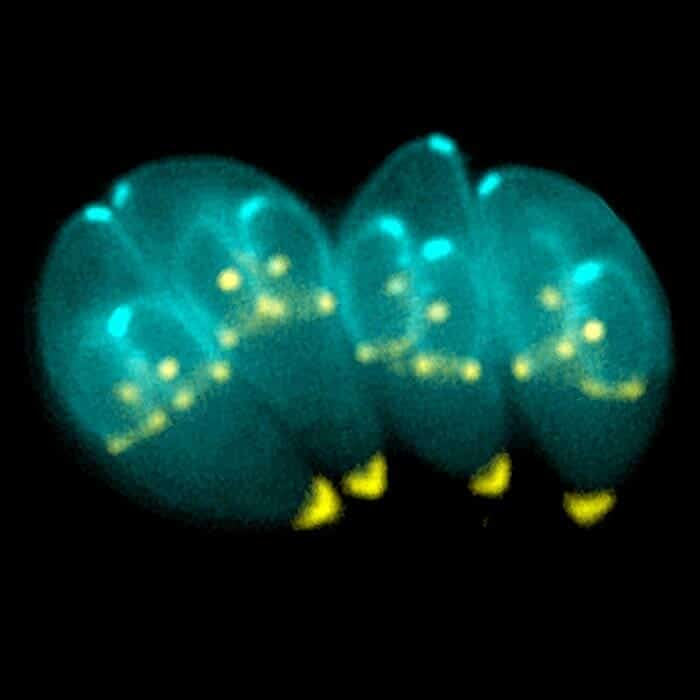 Toxoplasma_Gondii Toxoplasma_Gondii