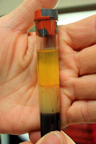 Blood Serum Blood Serum