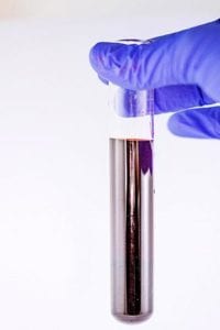 Pros and Cons of Genetic Testing Pros and Cons of Genetic Testing