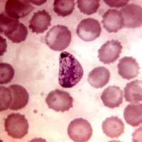 cytoplasm cytoplasm