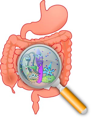 Ecoli Symptoms Ecoli Symptoms