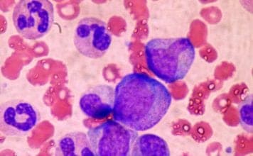 Hematopoietic Stem Cells (White Blood Cells) in Bone Marrow