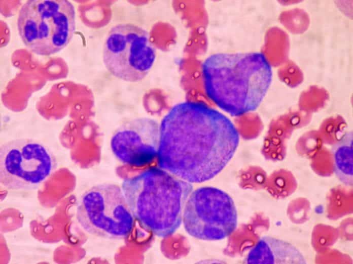 Hematopoietic Stem Cells (White Blood Cells) in Bone Marrow Hematopoietic Stem Cells (White Blood Cells) in Bone Marrow