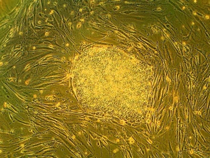 Where Do Stem Cells Come From Types Of Stem Cells BioExplorer Net Where Do Stem Cells Come From Types Of Stem Cells Bioexplorer Net