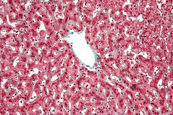 Kupffer Cells Kupffer Cells