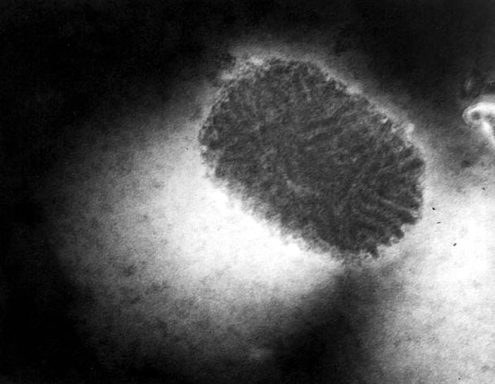Poxvirus Structure Poxvirus Structure