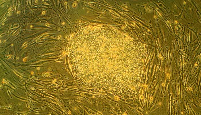Stem Cells Stem Cells