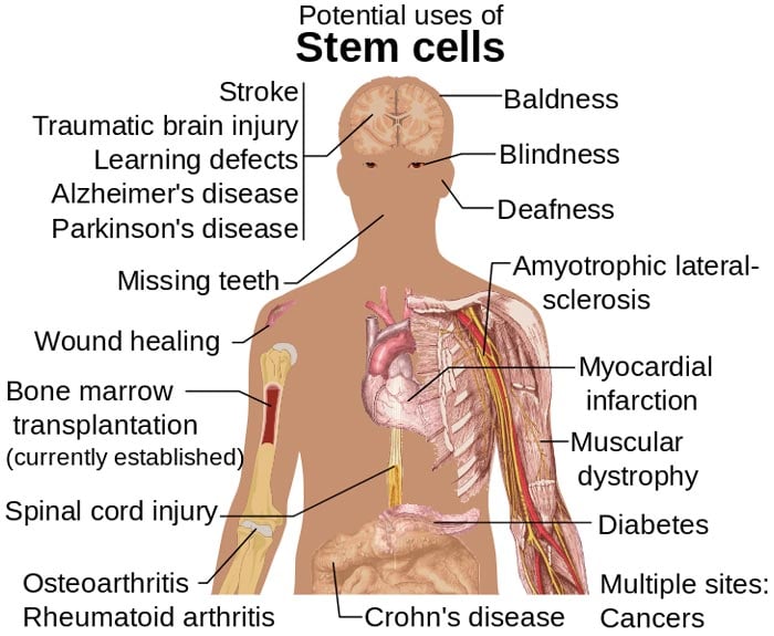 Stem Cell Treatments Stem Cell Treatments