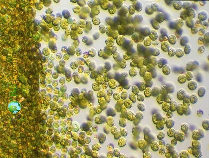 Toxic Gold Algae In Algal Bloom Under The Microscope Toxic Gold Algae In Algal Bloom Under The Microscope