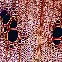 Water Conducting Cells (Xylem)