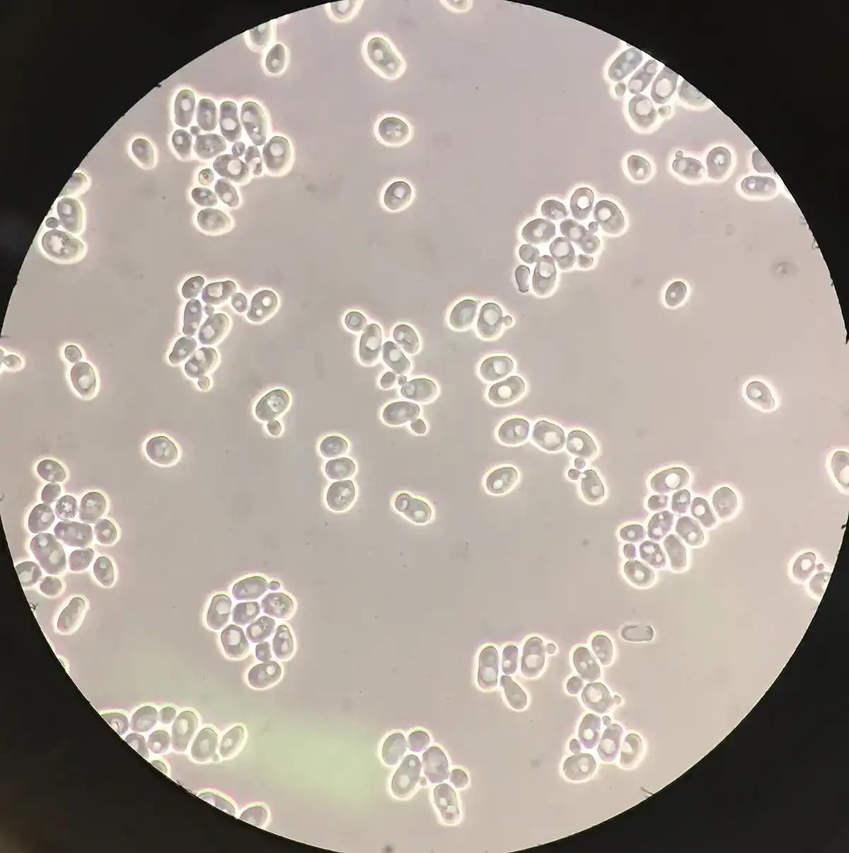 Phase-contrast microscopy image of living Saccharomyces cerevisiae yeast cells at 100x magnification, showing unstained cell outlines and internal granularity.