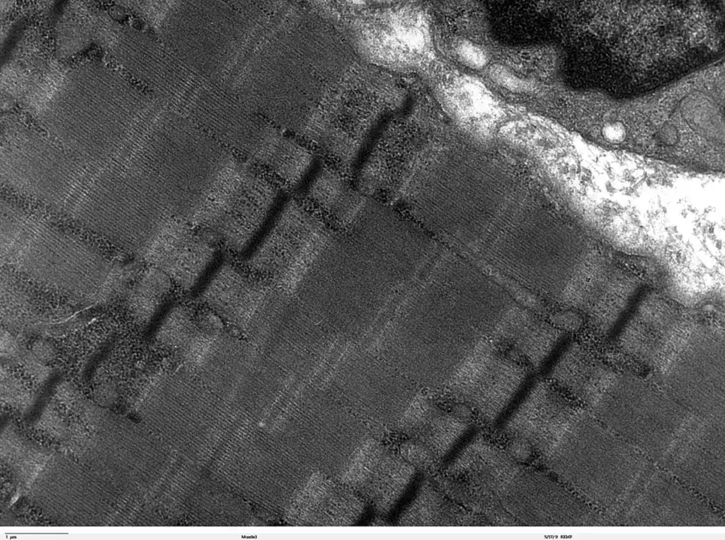 Transmission electron micrograph of human skeletal muscle tissue showing mitochondria associated with the contractile machinery. Muscle cells have substantial ATP requirements, making mitochondrial energy metabolism especially important in this tissue.