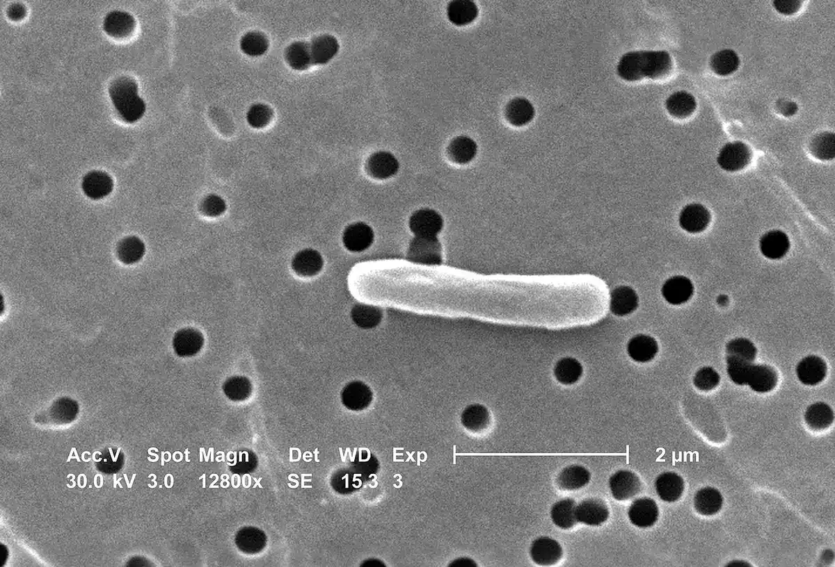 Scanning electron microscopy image of Escherichia coli bacteria showing rod-shaped cell surface topography.