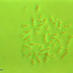 A human karyotype showing 46 chromosomes.
