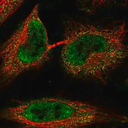 Immunofluorescence microscopy image of HeLa cells stained to show fluorescent antibody localization in the nucleoplasm and cytosol