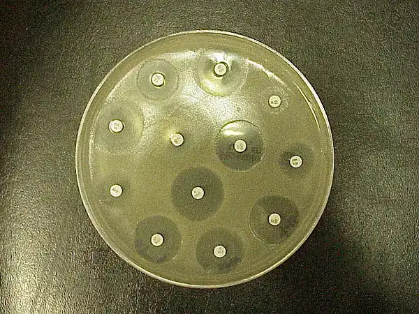 Kirby-Bauer disk diffusion plate showing antibiotic disks with zones of inhibition for antimicrobial susceptibility testing