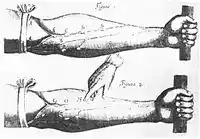 Illustration from Harvey's De Motu Cordis showing a human forearm with a cord tied above the elbow, marked to demonstrate the one-way valves inside the veins.