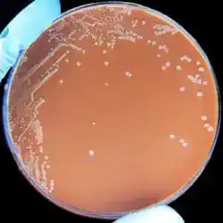 Haemophilus influenzae, the first free-living organism sequenced.