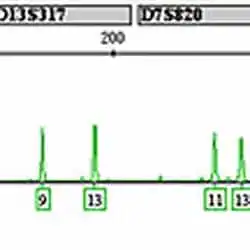 A DNA sequencing electropherogram.