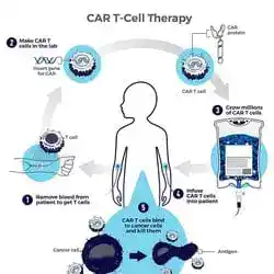 A chimeric antigen receptor T cell.