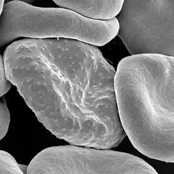 A red blood cell, the cell type corrected in sickle cell therapy.