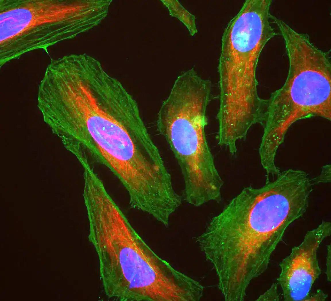 Fluorescence micrograph of HeLa cells with green actin filaments, a red vimentin network, and blue-stained nuclei