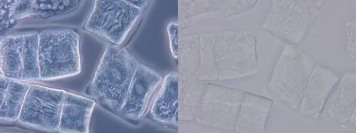 Side-by-side bright field and phase contrast micrographs of the same onion root tip cells, showing cells at different stages of mitosis.