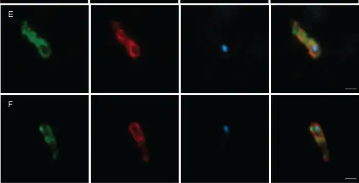 Fluorescence microscopy of elongated Asgard archaeal cells from marine sediment showing ribosomal signal and a single confined DNA focus
