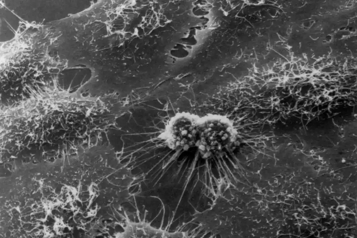 Black and white electron micrograph of HeLa cancer cells, with a rounded dividing cell at the center
