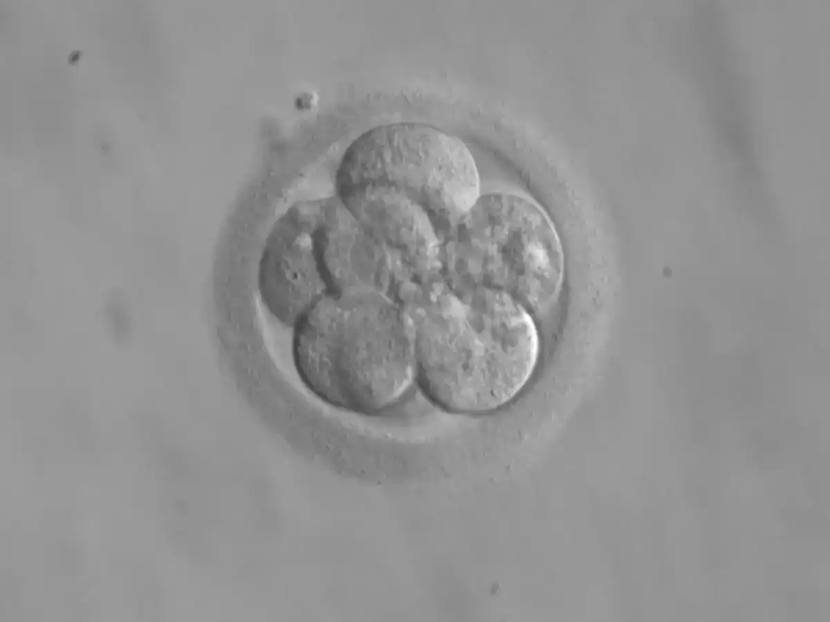 An eight-cell human embryo under a microscope, approximately three days after fertilization in IVF
