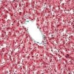Kupffer Cells