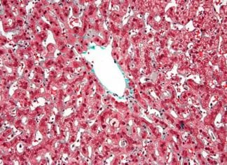 Kupffer Cells In Liver: Definition, Development, Anatomy, and Functions