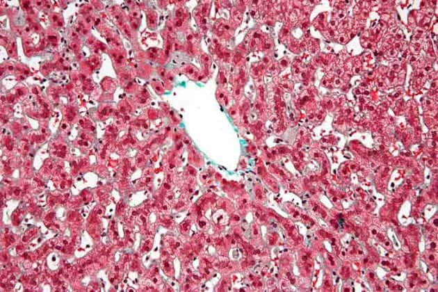 Kupffer Cells in Liver | Definition, Anatomy & Functions (Updated 2026)