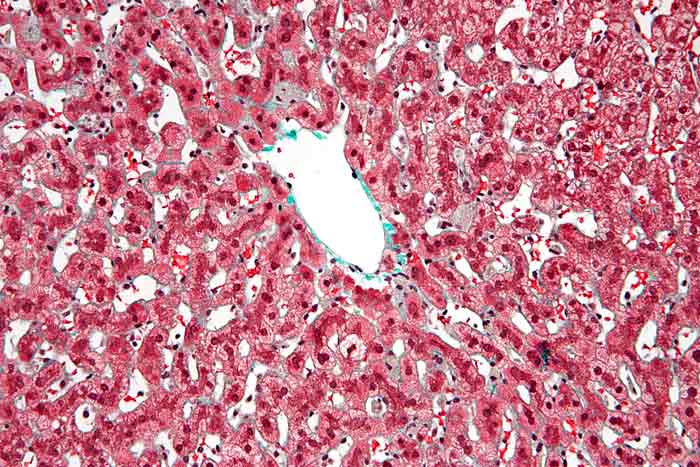 Kupffer Cells in Liver: Definition; Anatomy & Functions