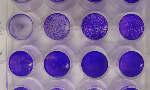 Multiwell tissue culture plate stained with crystal violet showing a virus dilution series. The well at upper left is almost completely cleared of cells, while the remaining wells show progressively fewer discrete white plaques against a deep violet monolayer as the virus is diluted further.