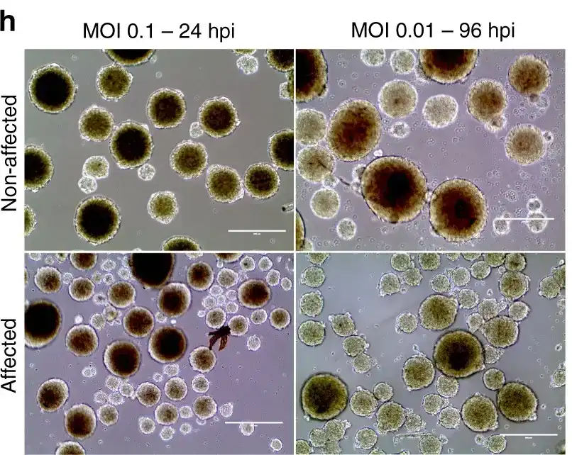 Four-panel brightfield micrograph comparing neurospheres from non-affected and affected donors after Zika virus infection, under two conditions labelled MOI 0.1 at 24 hours post-infection and MOI 0.01 at 96 hours post-infection. Non-affected neurospheres remain large, round and densely pigmented, while affected neurospheres are smaller, paler and more irregular.