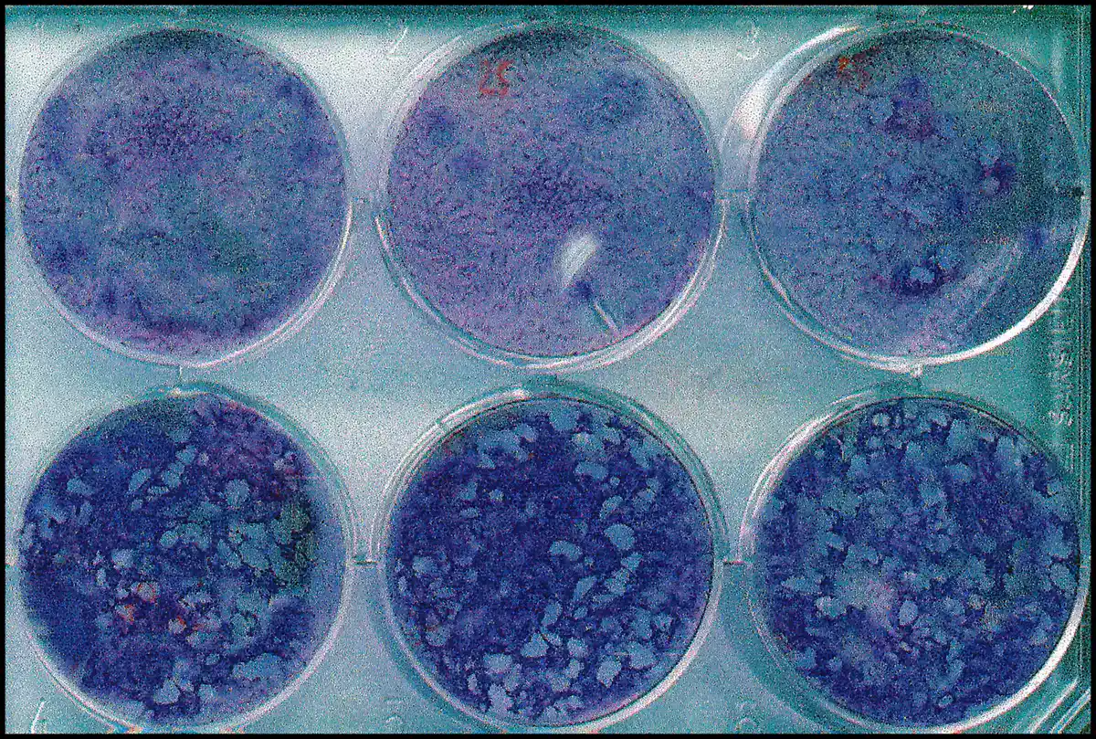 Six-well tissue culture plate stained with crystal violet after a plaque assay. The three upper wells show largely intact violet monolayers, while the three lower wells show numerous pale plaques where virus has destroyed the cells, many of them merged rather than discrete.