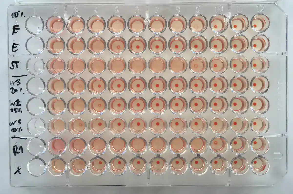 Ninety-six well round-bottom plate from a hemagglutination assay. Wells at lower dilutions show a diffuse pink film of agglutinated red blood cells, while wells at higher dilutions show a distinct compact red button where unagglutinated cells have settled. The point where the pattern changes marks the hemagglutination titer for each row.