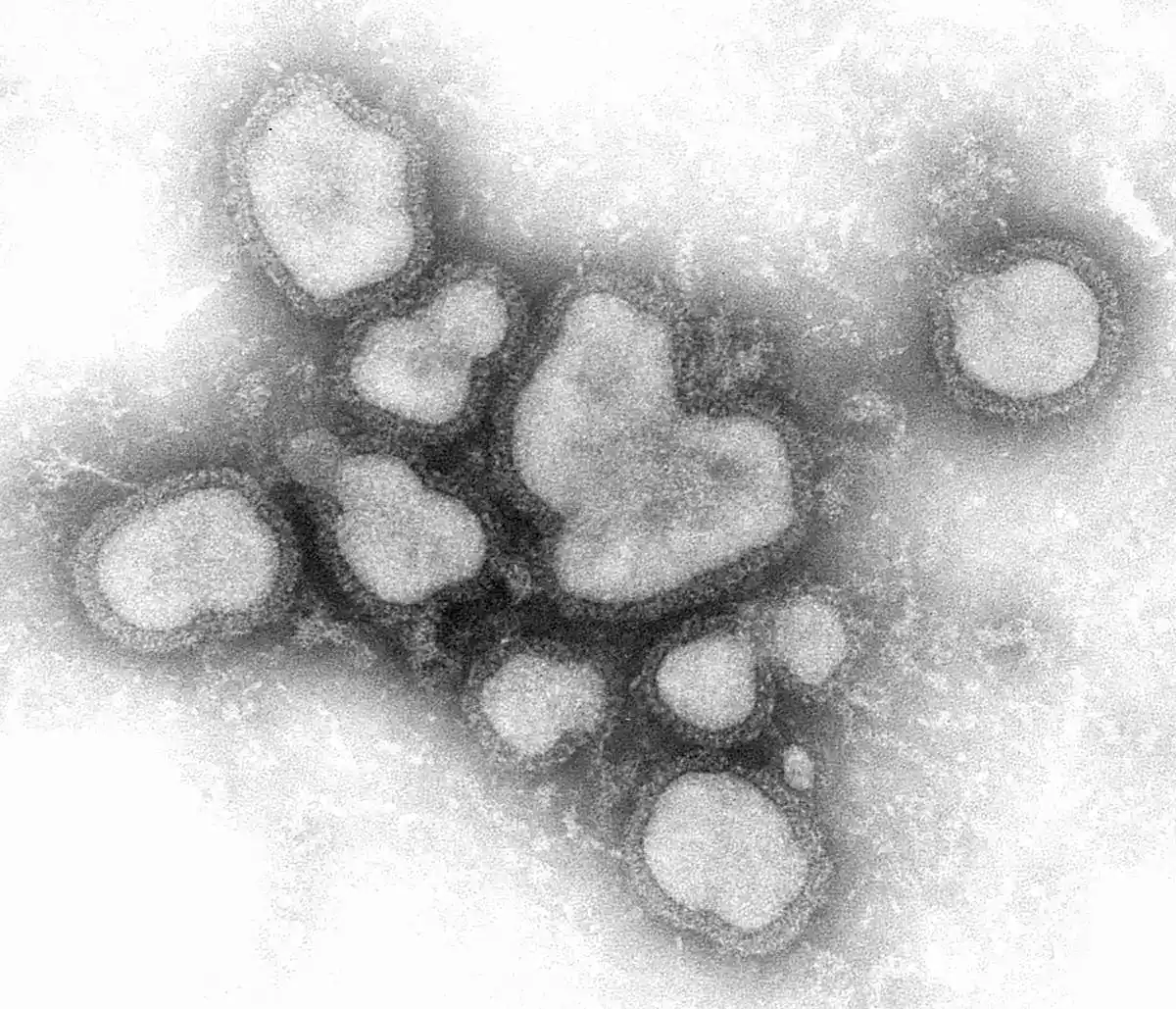 Transmission electron micrograph of negatively stained influenza A virions. About ten roughly spherical, pleomorphic enveloped particles are visible in greyscale, each outlined by a dark rim of surface glycoprotein spikes.