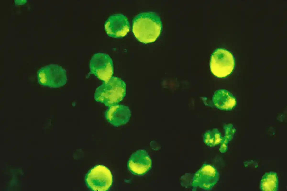 Positive immunofluorescence result. Rounded cells fluoresce bright yellow-green against a black background where labelled antibody has bound its target antigen.