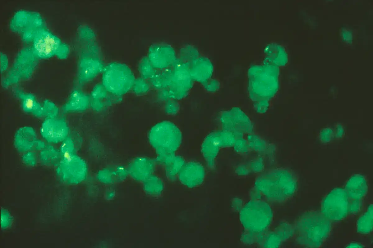 Negative immunofluorescence control. Rounded cells show only dim, dull green fluorescence against a black background, markedly weaker than the positive result but not entirely dark.